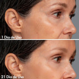 Massageador Facial com Fototerapia Anti-Rugas DermaLift