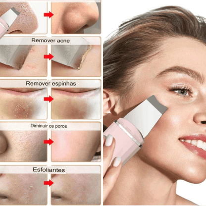 Pure Skin - Peeling Ultrassônico Facial Limpeza Profunda