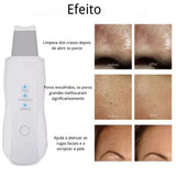 Pure Skin — Peeling Ultrassônico Facial