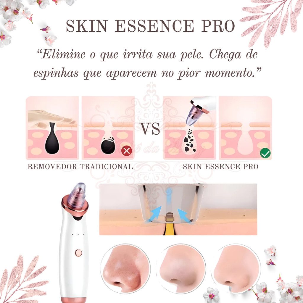 Skin Essence Pro™ – Removedor de Cravos a Vácuo com Limpeza Profunda Profissional
