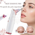 Skin Essence Pro™ – Removedor de Cravos a Vácuo com Limpeza Profunda Profissional