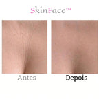 SkinFace™ - Adesivos de Silicone Rejuvenescedor Anti Rugas